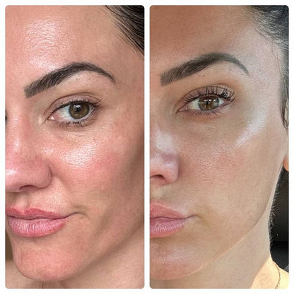 Vitamin C Face Serum 30ml